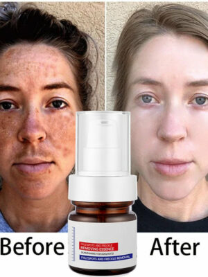 5-second brightening rescue